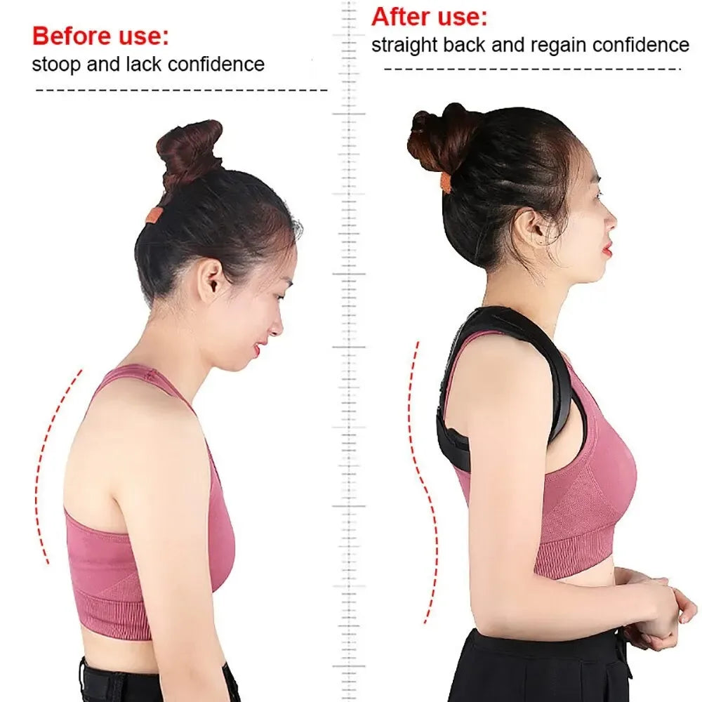 Adjustable Posture Corrector™